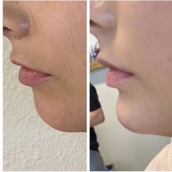 Jeuvani Spa and Sculpting