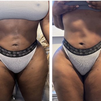 Snatched LV - Skin Care Near Me - Las Vegas, Nevada Snatched LV - Skin Care Near Me - Las Vegas, Nevada