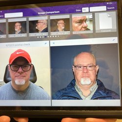 Piedmont Plastic Surgery & Dermatology - My results- way to go, Dr. Roeder!!! You're the best!!!