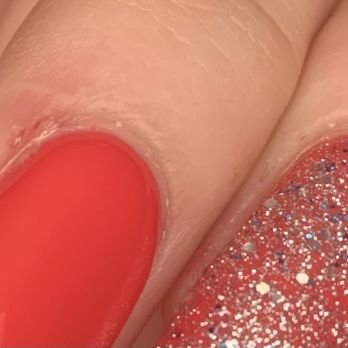 Aqua Nail Salon and Spa - Cuts in cuticle area - Hair Removal Near Me - Lexington, South Carolina