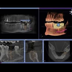Brighter Day Dental - 3D imaging for your safety and comfort