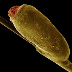 The Lice Place - Louse Egg aka Nit