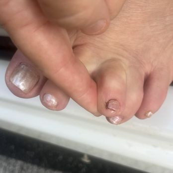 Hollywood Nails & Spa - Toe injury - Nail Salons Near Me - Leland, North Carolina