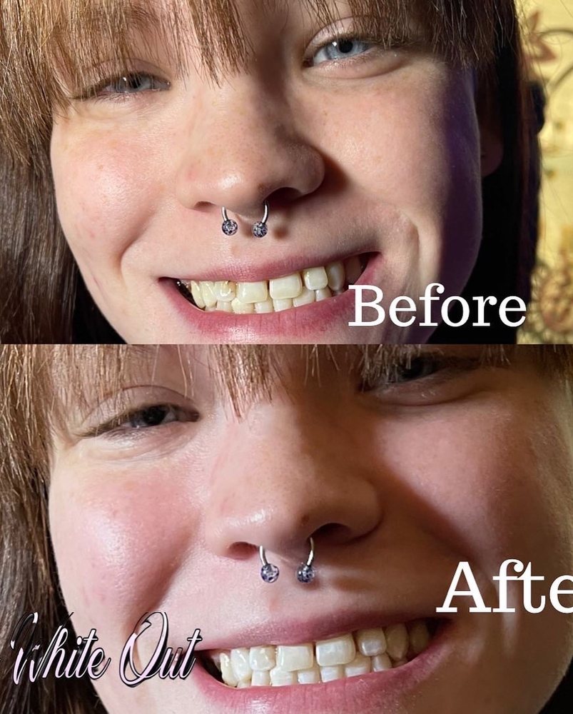 THE WHITE OUT Updated April 2024 Request an Appointment 2389