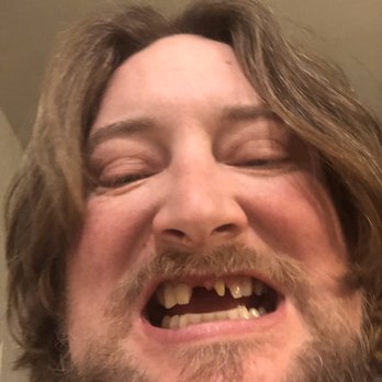 Perfect Teeth - 3 moths like this - General Dentistry Near Me - Loveland, Colorado Perfect Teeth - 3 moths like this - General Dentistry Near Me - Loveland, Colorado