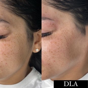 DLA Aesthetics - Eyelash Service Near Me - Calabasas, California DLA Aesthetics - Eyelash Service Near Me - Calabasas, California