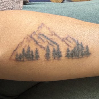 Reno Tattoo Removal - after 3 sessions - Tattoo Removal Near Me - Reno, Nevada Reno Tattoo Removal - after 3 sessions - Tattoo Removal Near Me - Reno, Nevada