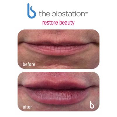 the biostation by null