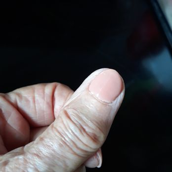 Best Nails - Note white dry skin surrounding the nail. Could be this is what happens with "dipping.?' - Nail Salons Near Me - San Marcos, California Best Nails - Note white dry skin surrounding the nail. Could be this is what happens with "dipping.?' - Nail Salons Near Me - San Marcos, California