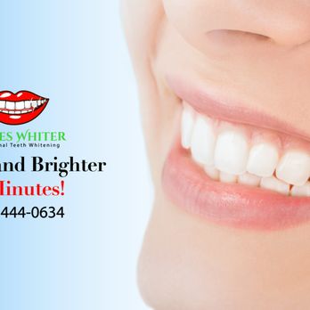 Shades Whiter - Brighter in minutes - Teeth Whitening Near Me - Saint Matthews, Kentucky Shades Whiter - Brighter in minutes - Teeth Whitening Near Me - Saint Matthews, Kentucky