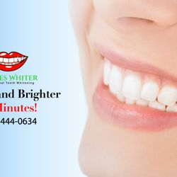 Shades Whiter - Brighter in minutes