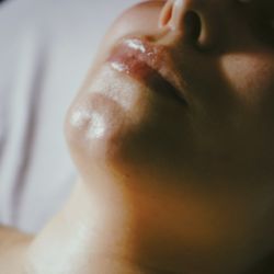 HealthAccel Skin  Wellness Spa - Facial