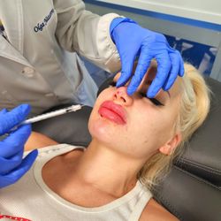 Glamour Medical Aesthetics - Lip Injection