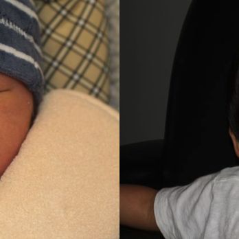 Lee Facial Plastic Surgery - Before and After from Lee Facial Plastic Surgery | Boston, MA - Plastic Surgeons Near Me - Boston, Massachusetts Lee Facial Plastic Surgery - Before and After from Lee Facial Plastic Surgery | Boston, MA - Plastic Surgeons Near Me - Boston, Massachusetts