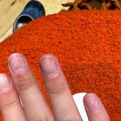 Fishtown Nails Bar Cafe - Drilled down nails from dip removal - dented and painful for weeks after