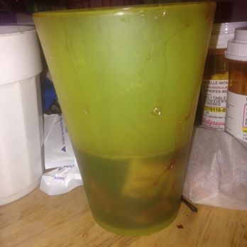 Karen Nash, DDS - The cup of blood - General Dentistry Near Me - Chicago, Illinois