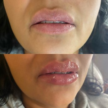 Top Beauty - Skin Care Near Me - Orange, California Top Beauty - Skin Care Near Me - Orange, California