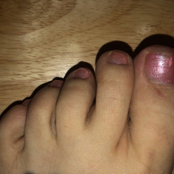 Hot Tips Nails and Spa - Bad (and painful) pedicure - Nail Salons Near Me - Denver, Colorado