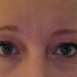 Messed up, uneven eyebrows.