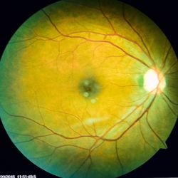 First Eye Care - Diabetic eye exams