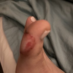 OOB Nails & Spa - That's my toe botched up again
