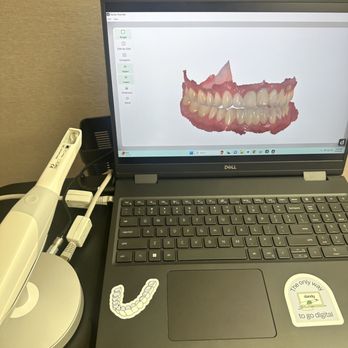 TLC Dentistry - We use digital intraoral scanning for crowns, bridges, implants, orthodontics, and more! - Cosmetic Dentists Near Me - Dunedin, Florida TLC Dentistry - We use digital intraoral scanning for crowns, bridges, implants, orthodontics, and more! - Cosmetic Dentists Near Me - Dunedin, Florida
