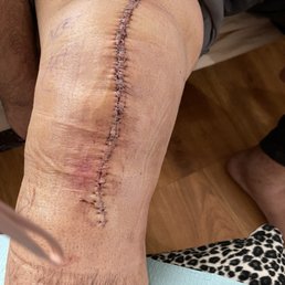 My right knee