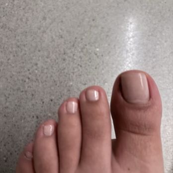 Chic Nails & Lashes - Current state of toe - Nail Salons Near Me - Los Angeles, California