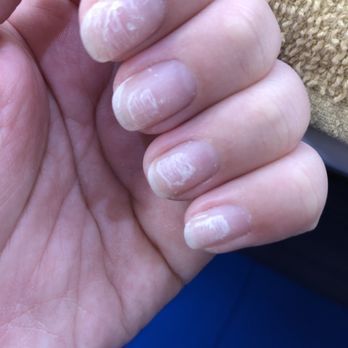 Pearl Nails - Nails after dip powder removal - Nail Salons Near Me - Rosemead, California Pearl Nails - Nails after dip powder removal - Nail Salons Near Me - Rosemead, California