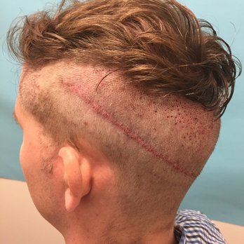McGrath Medical - Hair Loss Centers Near Me - Austin, Texas McGrath Medical - Hair Loss Centers Near Me - Austin, Texas