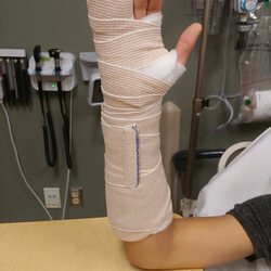Sumner Station Emergency Room - Once splint applied.