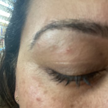 Soi Brow Threading Salon - I have Cuts on both my eye lids - Threading Services Near Me - McKinney, Texas