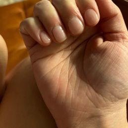 Tore cuticles, patchy and bubble dip.