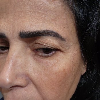 Roman Rayham, MD - Before pic - Cosmetic Surgeons Near Me - Brooklyn, New York Roman Rayham, MD - Before pic - Cosmetic Surgeons Near Me - Brooklyn, New York