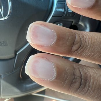 Ivy Nails - After manicure, completely ruined nail bed. - Nail Salons Near Me - Alexandria, Virginia Ivy Nails - After manicure, completely ruined nail bed. - Nail Salons Near Me - Alexandria, Virginia