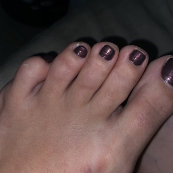 Gel Nails & Spa - Dead skin uneven toenail shapes . This is what my pedi looked like. - Nail Salons Near Me - Placentia, California Gel Nails & Spa - Dead skin uneven toenail shapes . This is what my pedi looked like. - Nail Salons Near Me - Placentia, California