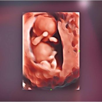 Bonding Moments - Ultrasound Imaging Centers Near Me - Chillicothe, Ohio