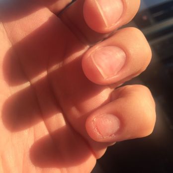 OBI Nail & Spa - Left hand. Pinky nail ripped part way off my nail bed. - Nail Salons Near Me - Mesa, Arizona