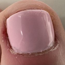 Lily Nails - One of the 10 toes. Not cool.