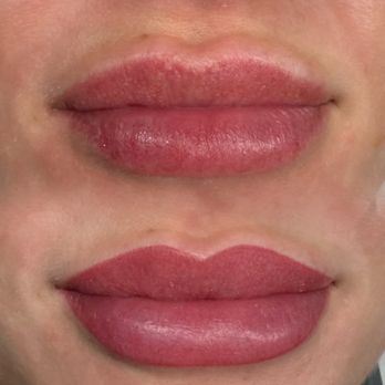 Selfishly Aesthetics & Wellness - My lips - Medical Spas Near Me - San Francisco, California Selfishly Aesthetics & Wellness - My lips - Medical Spas Near Me - San Francisco, California