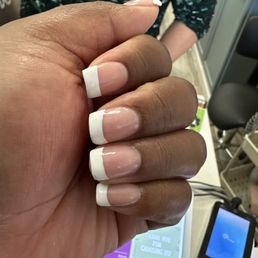 What NV did before I got them fixed.