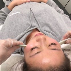 Kien Toan Acupuncture and Herbs - Facial gua sha
