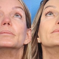 Holcomb - Kreithen Plastic Surgery & Medspa
