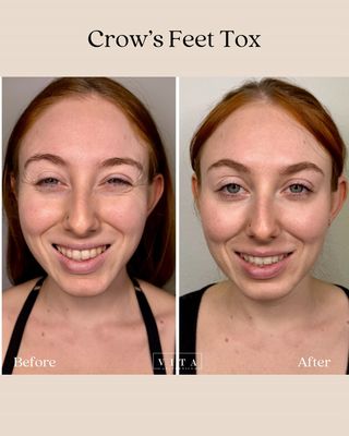 VITA AESTHETICS - Updated February 2026 - 50 Photos & 13 Reviews