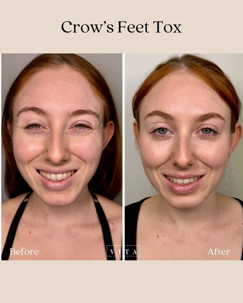 Vita Aesthetics Logo