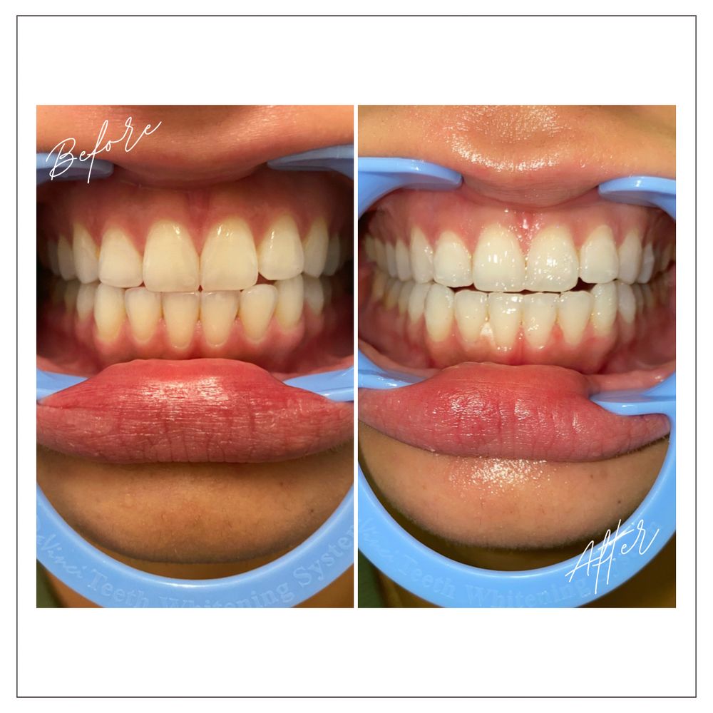 JADE BEAUTY BAR 35 Photos 16552 Heath Dr, Lapine, Oregon Body Contouring Phone Number Yelp