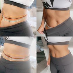 Weight Loss Solutions