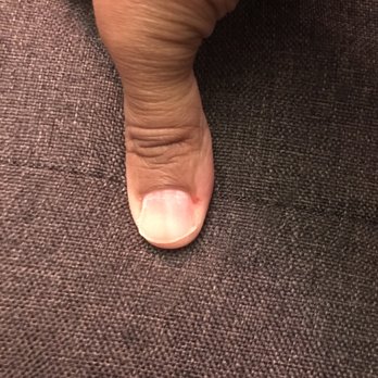 Bling Nail Salon - My thumb was injured as well and blood is still visible through the skin. - Nail Salons Near Me - Dallas, Texas