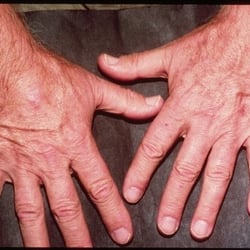 Bernadette Mayer, MD- MedSpa and Wellness Center - After