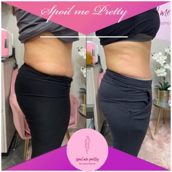 Spoil Me Pretty Aesthetics - Before and After